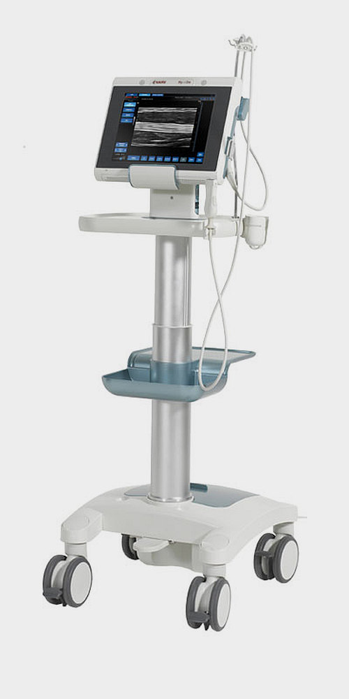 УЗИ аппарат портативный